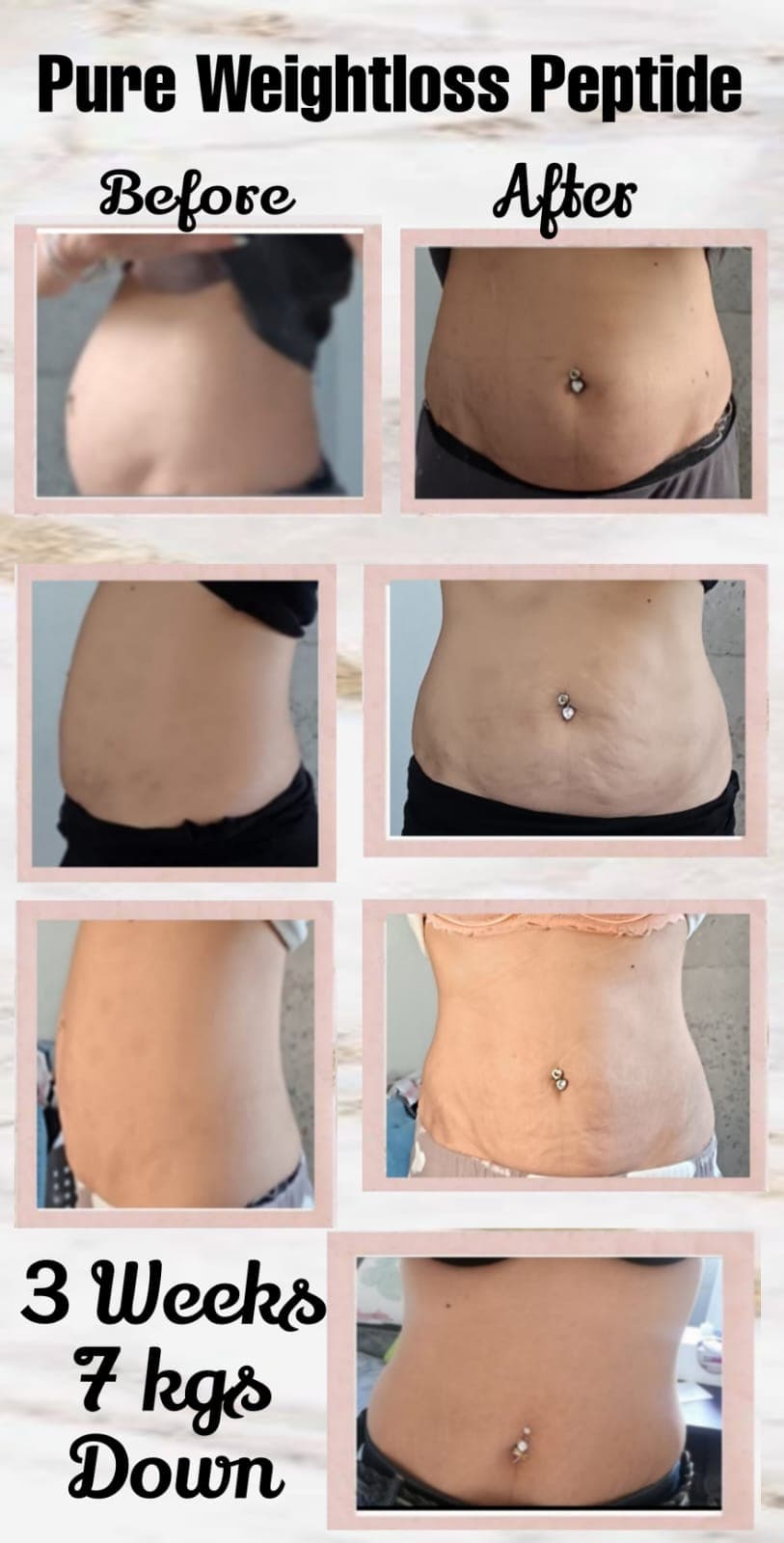 Injectables & Lipolysis